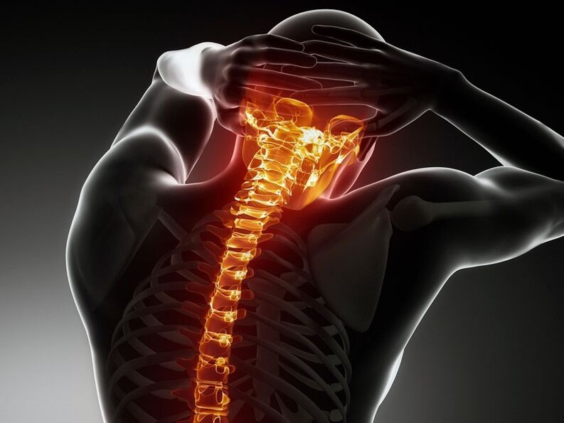 Awọn aami aisan ti osteochondrosis