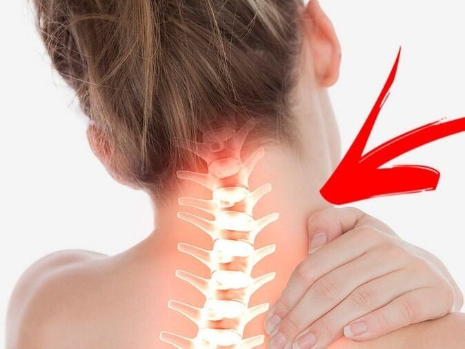 Funmora fun awọn gbongbo aifọkanbalẹ pẹlu osteochondrosis