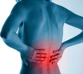 osteochondrosis lumbar