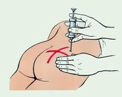 abẹrẹ fun itọju osteochondrosis