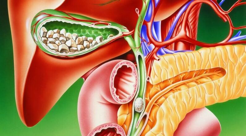 gallbladder ipo aworan atọka